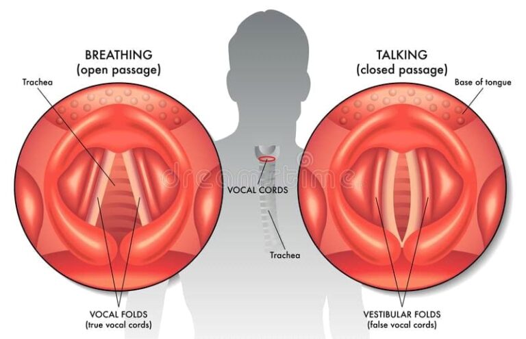 how-to-avoid-vocal-strain-in-2020-learn-singing-vocal-singing